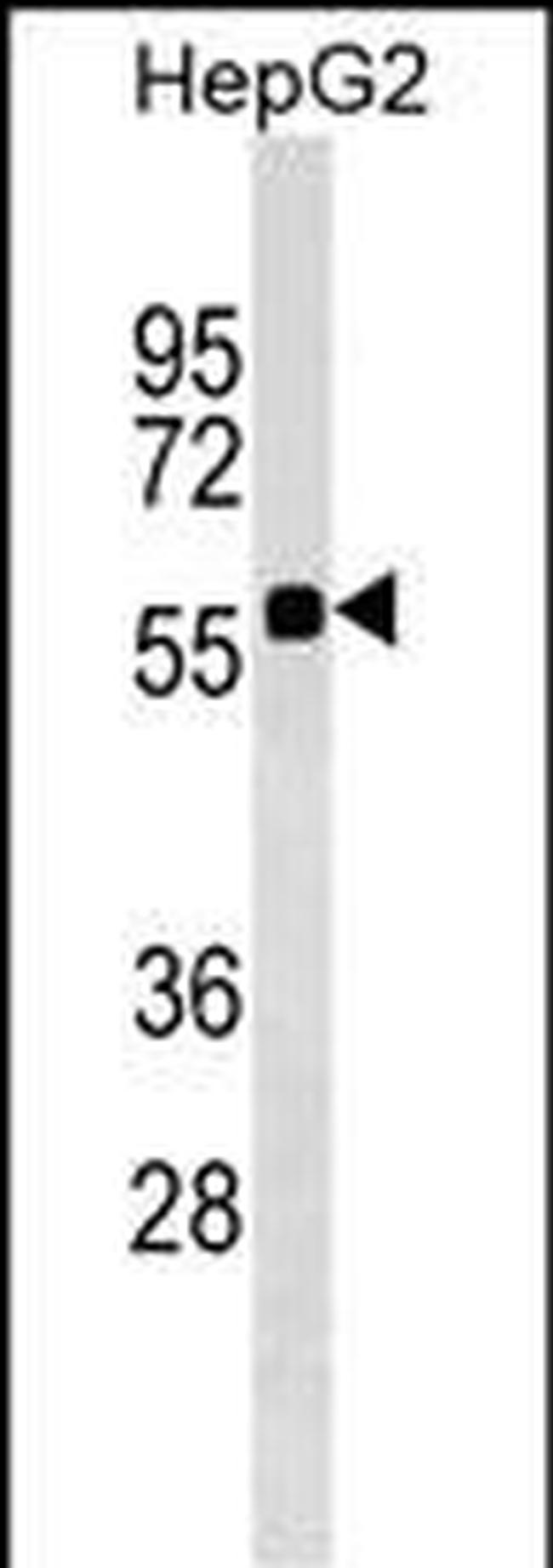 SRCRB4D Antibody in Western Blot (WB)