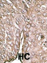 LC3B Antibody in Immunohistochemistry (Paraffin) (IHC (P))