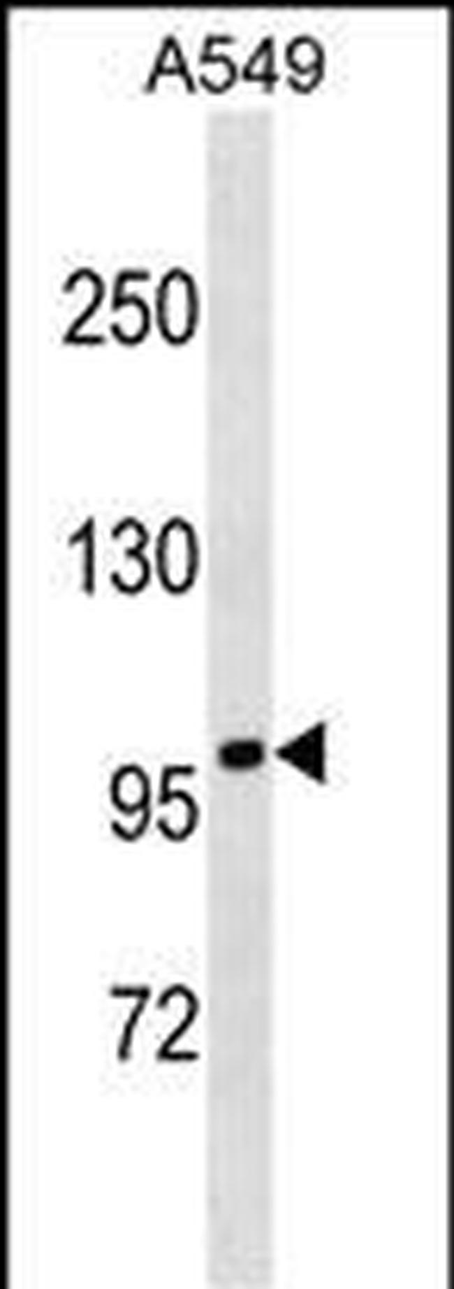 FANCB Antibody in Western Blot (WB)
