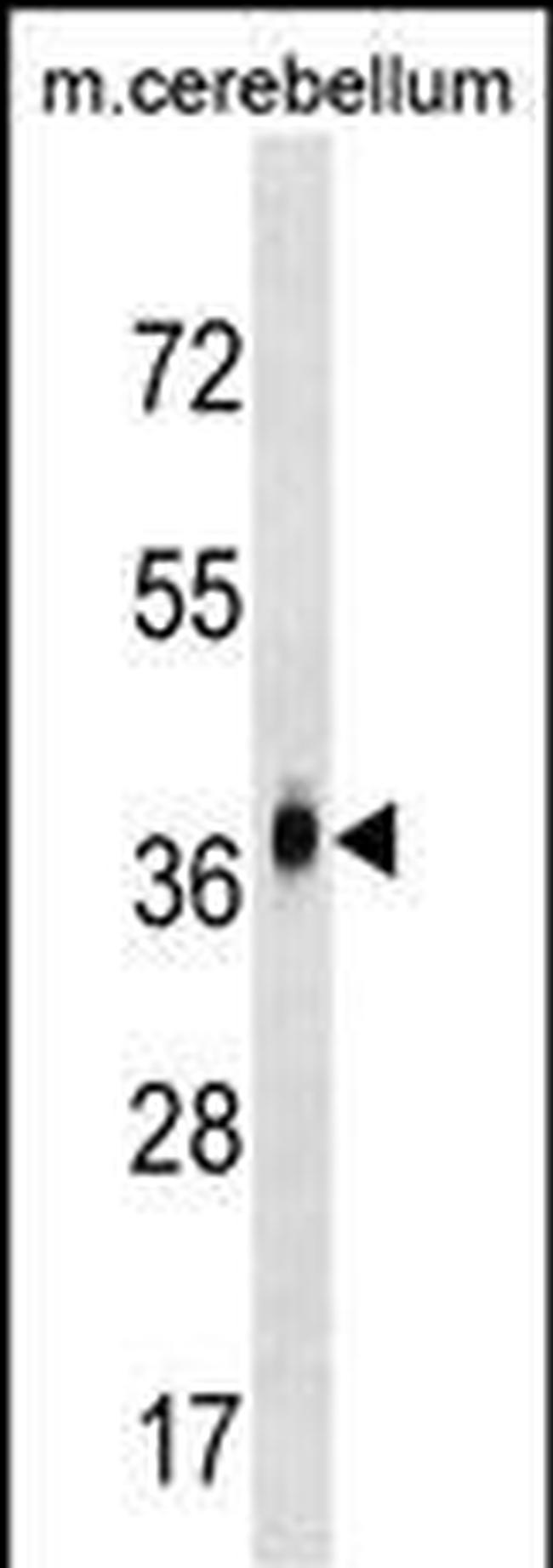 MMD2 Antibody in Western Blot (WB)