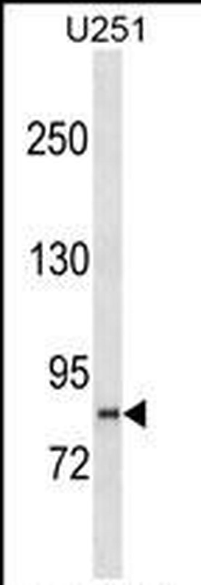 PCDHGB2 Antibody in Western Blot (WB)