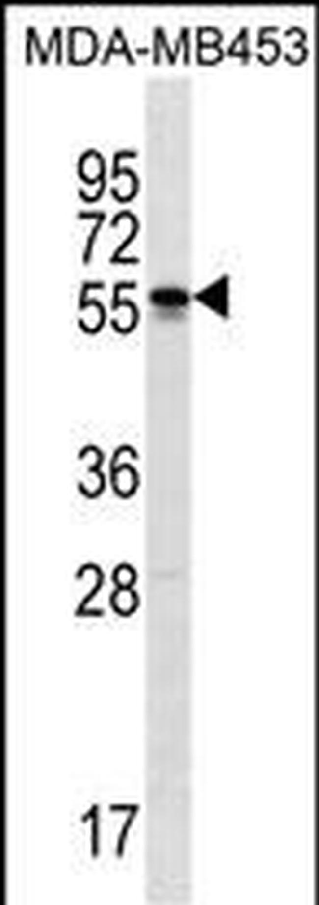 SOHLH2 Antibody in Western Blot (WB)