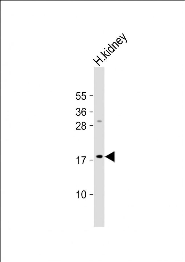 LYZL1 Antibody in Western Blot (WB)