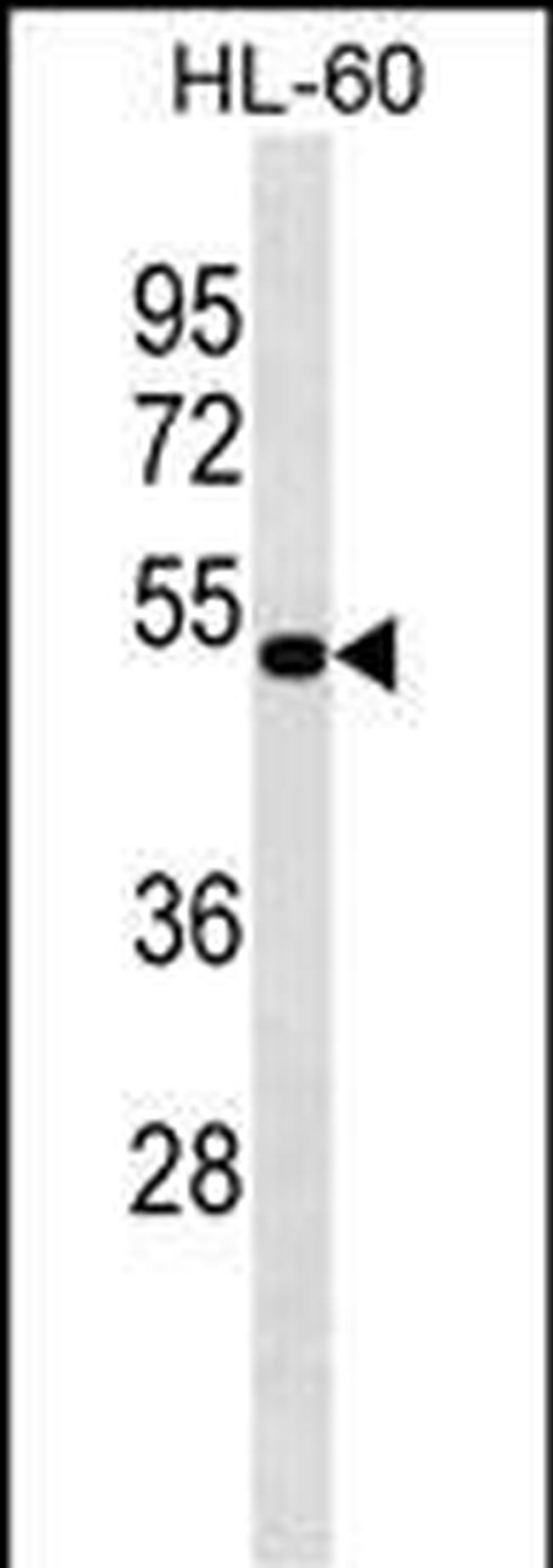 ASAHL Antibody in Western Blot (WB)