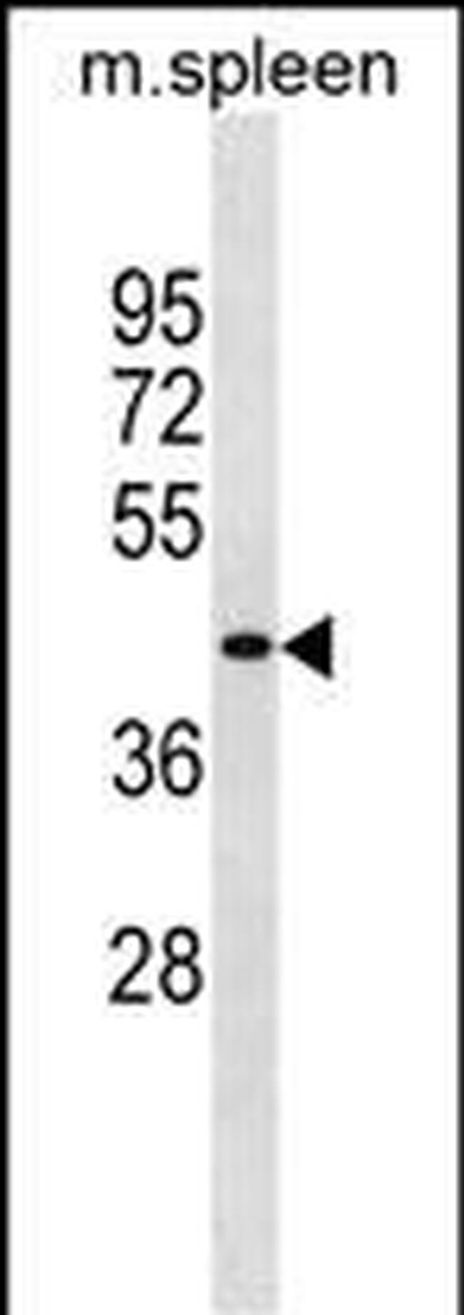 SLC10A2 Antibody in Western Blot (WB)