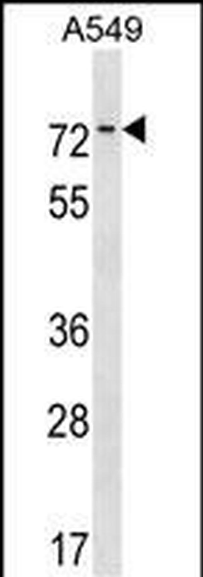 HKR1 Antibody in Western Blot (WB)