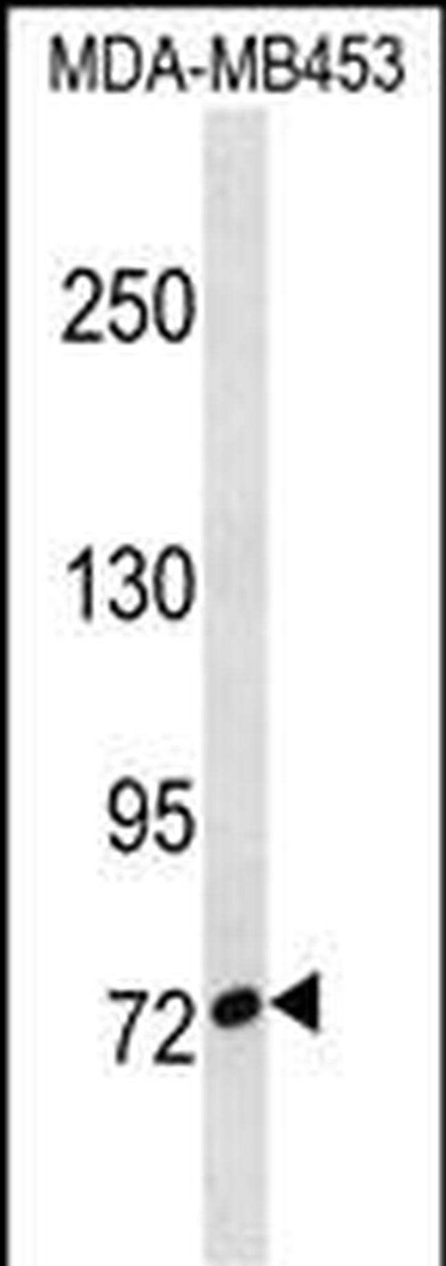 CUX1 Antibody in Western Blot (WB)