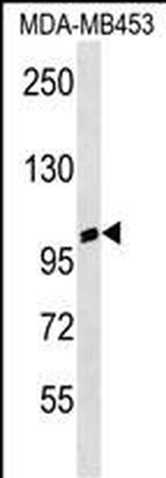 A20A3 Antibody in Western Blot (WB)