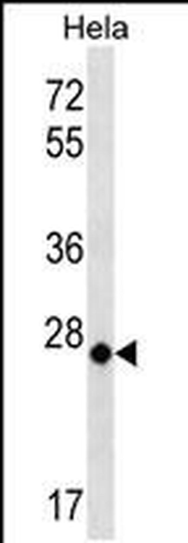 COX3 Antibody in Western Blot (WB)