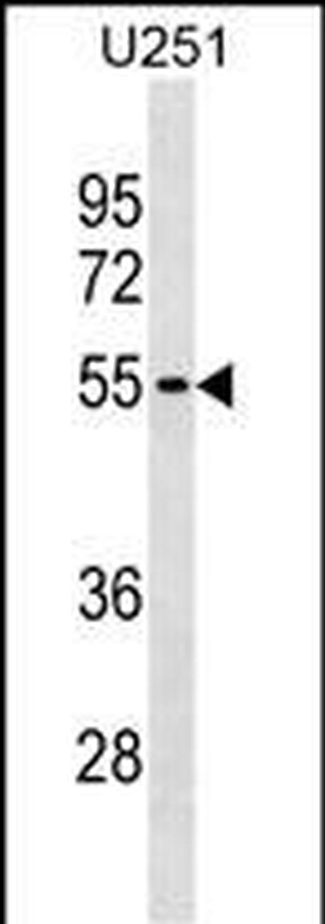 KLHDC7B Antibody in Western Blot (WB)