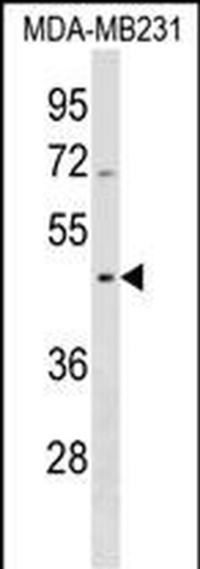 SEPT12 Antibody in Western Blot (WB)