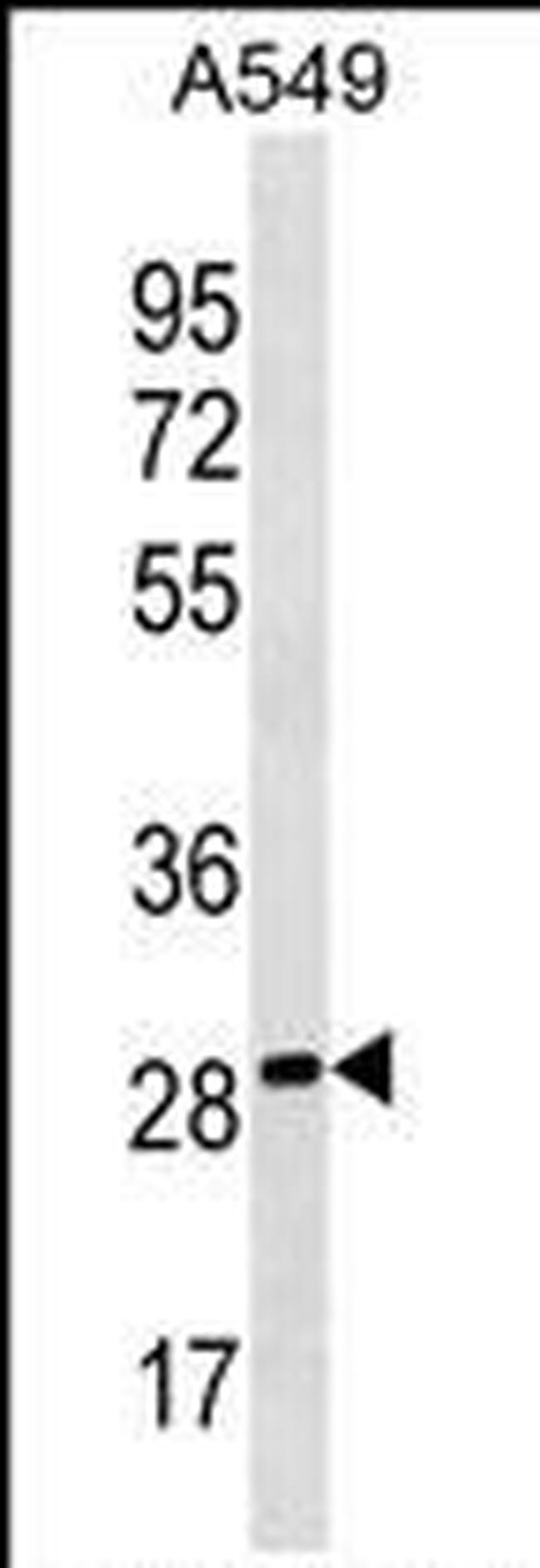 PEBP4 Antibody in Western Blot (WB)
