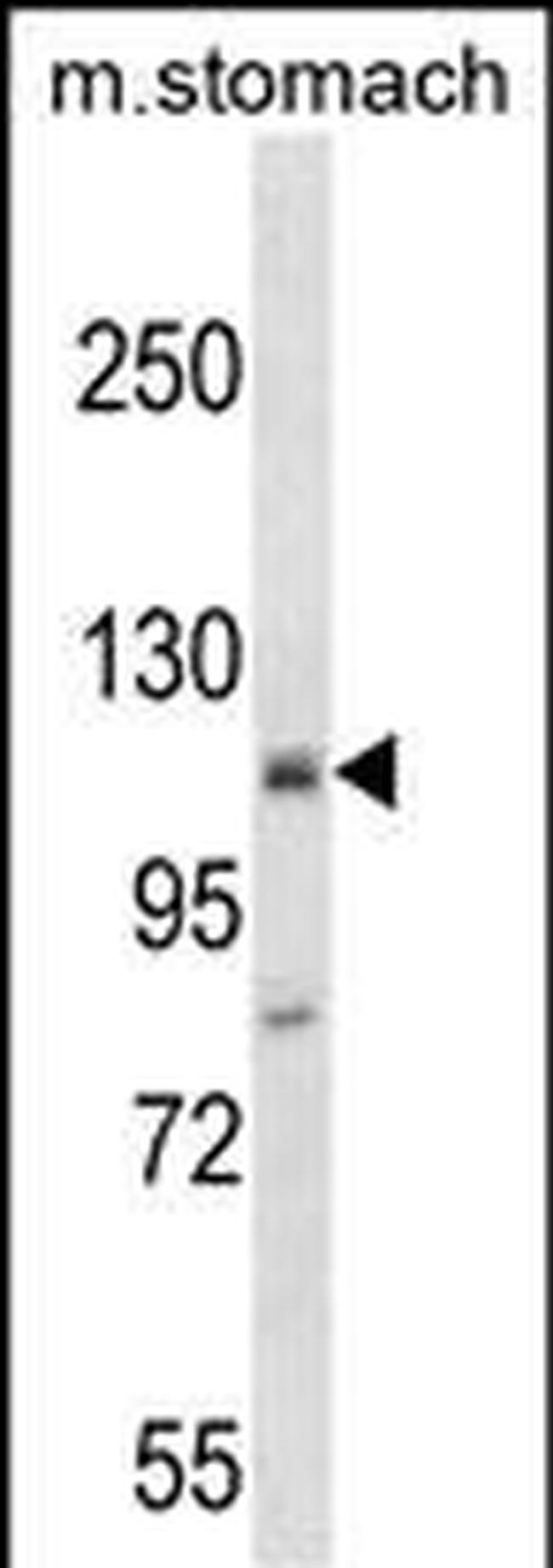 ST18 Antibody in Western Blot (WB)