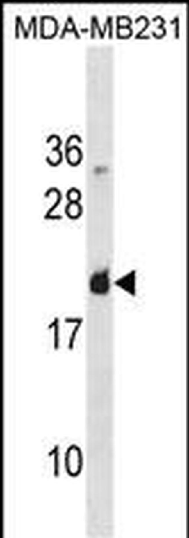Galectin 7 Antibody in Western Blot (WB)