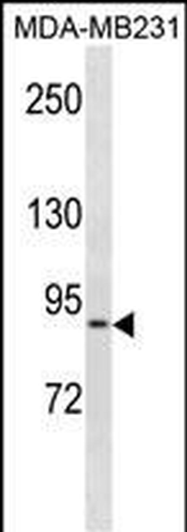 KIRREL Antibody in Western Blot (WB)