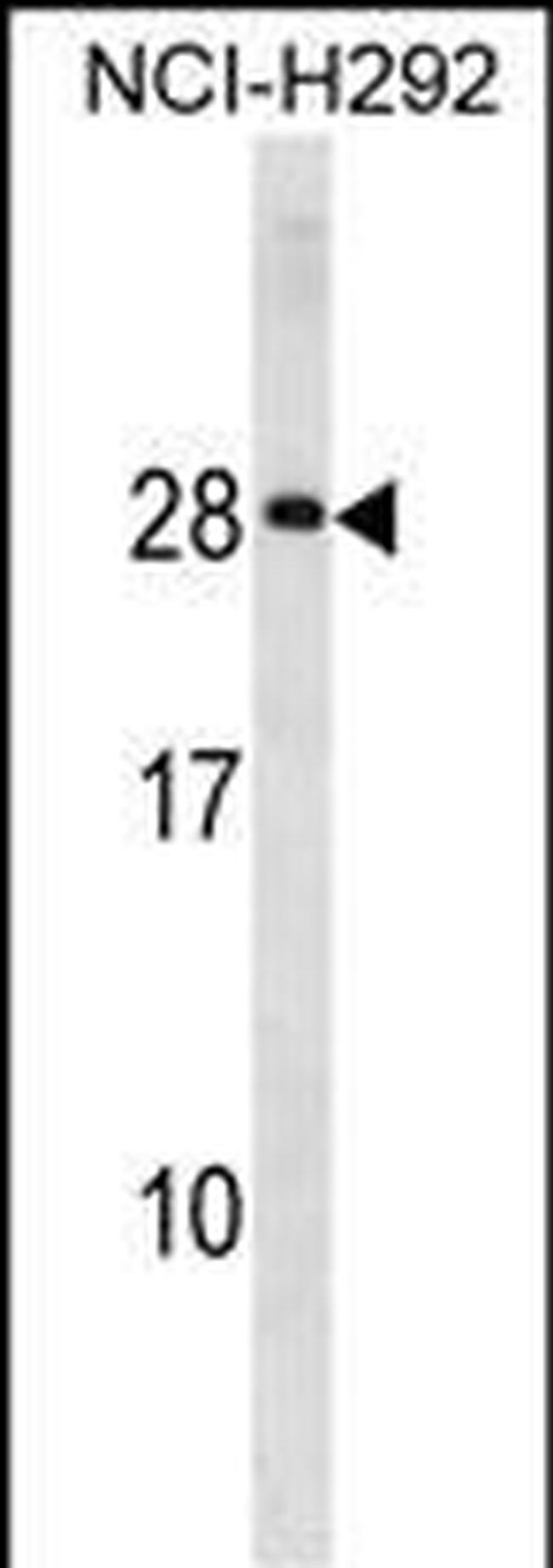 HLA-DQA2 Antibody in Western Blot (WB)