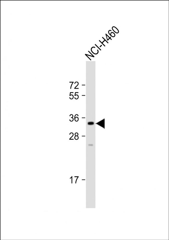FAM26F Antibody in Western Blot (WB)
