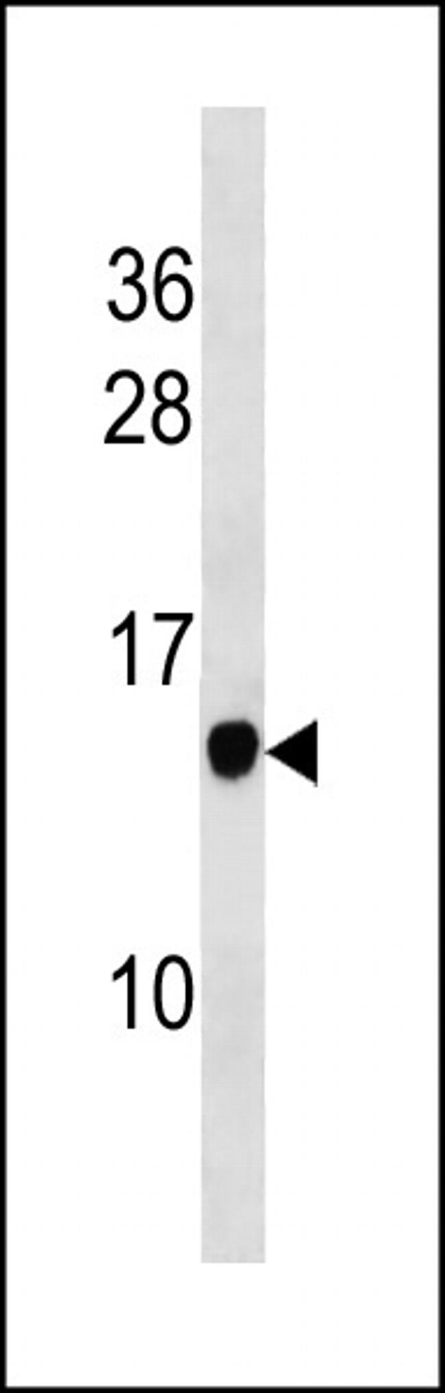 POMP Antibody in Western Blot (WB)