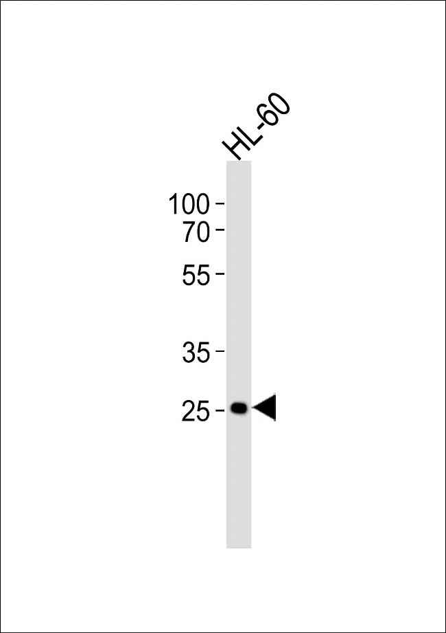 CD16 Antibody in Western Blot (WB)