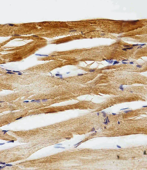 GFAP Antibody in Immunohistochemistry (Paraffin) (IHC (P))