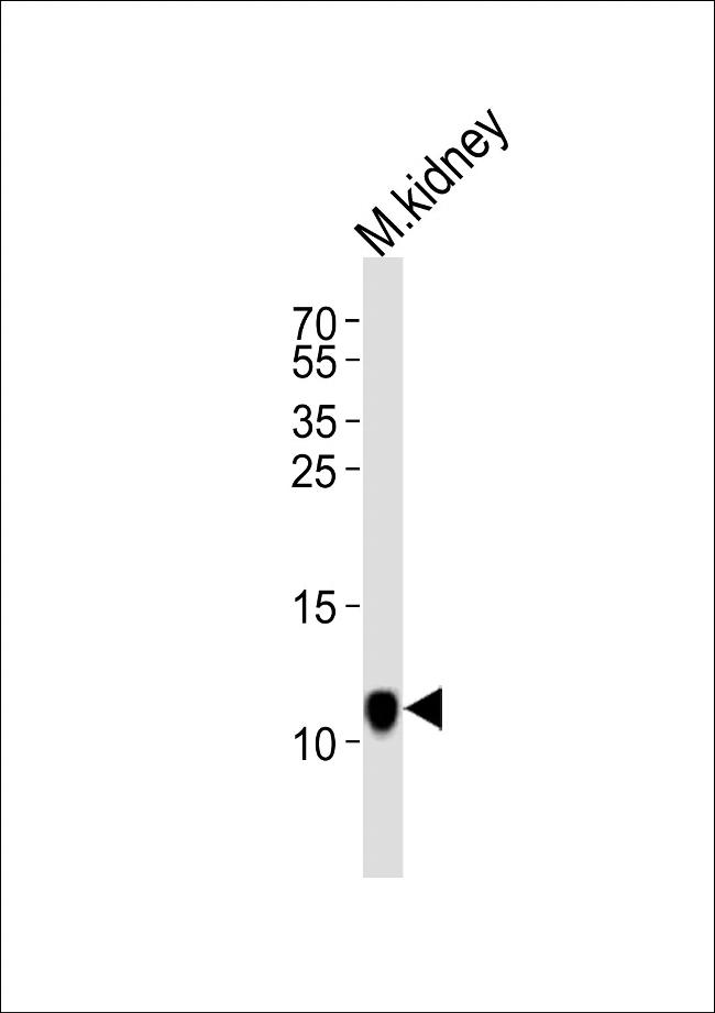 C1orf151 Antibody in Western Blot (WB)