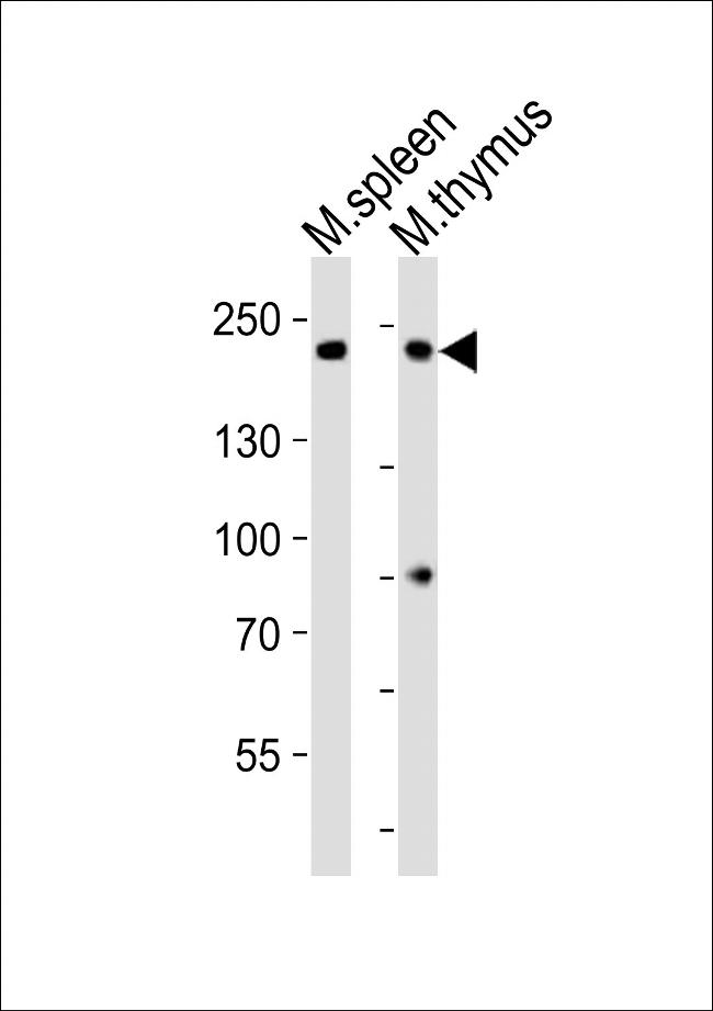 ZCCHC11 Antibody in Western Blot (WB)
