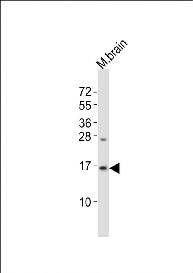 LC3B Antibody in Western Blot (WB)