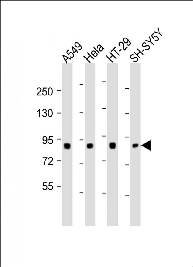 SEMA4G Antibody in Western Blot (WB)