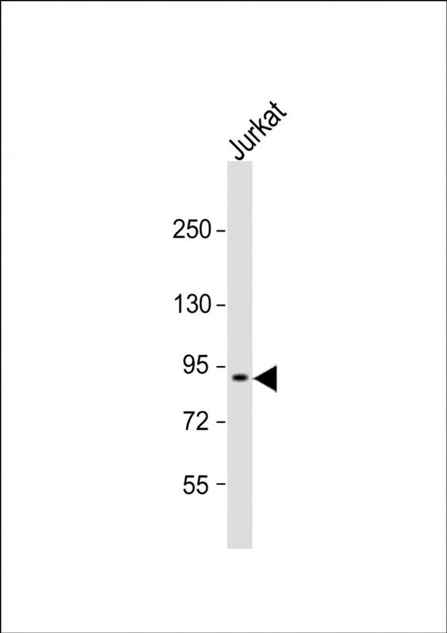 CTAGE6 Antibody in Western Blot (WB)