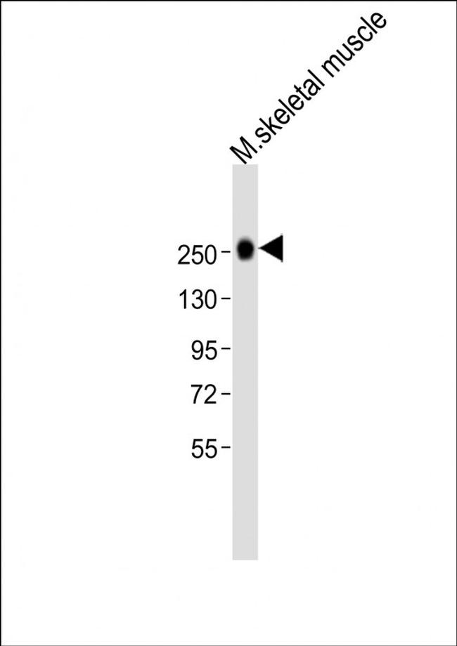 Myosin Heavy Chain Antibody in Western Blot (WB)