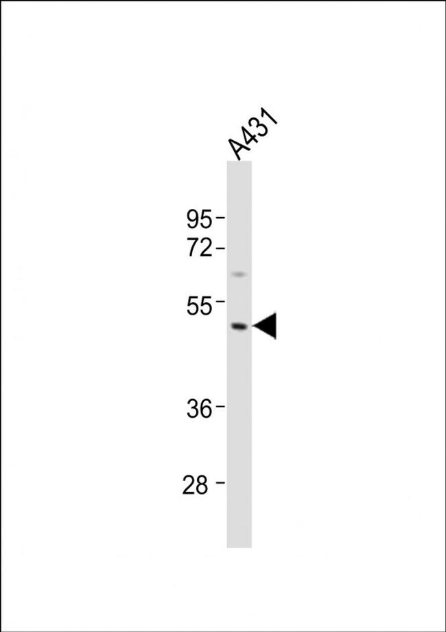 MMP23 Antibody in Western Blot (WB)