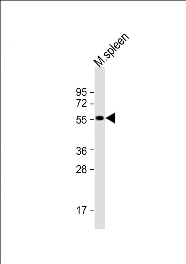 SRMS Antibody in Western Blot (WB)