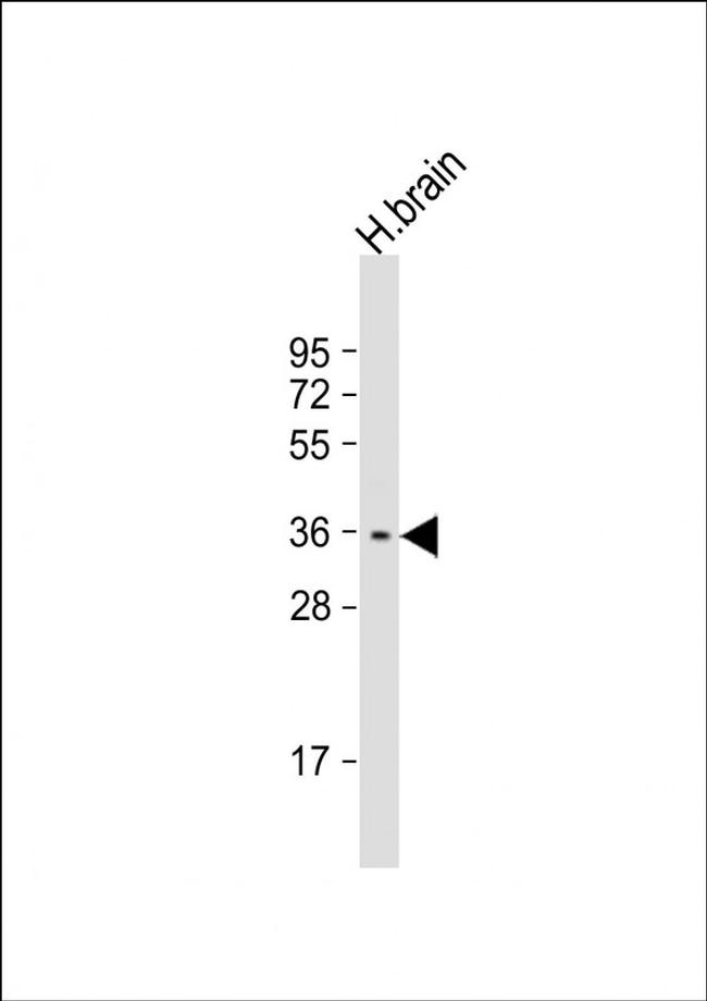 STPG1 Antibody in Western Blot (WB)