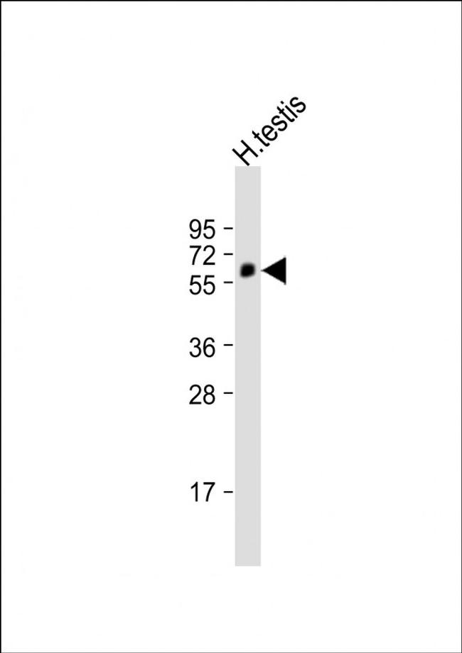 POTEM Antibody in Western Blot (WB)