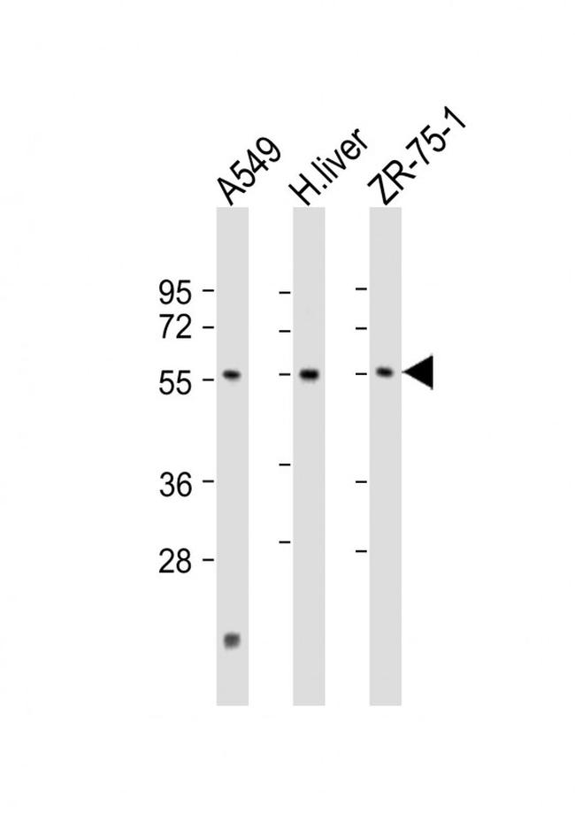 PM20D1 Antibody in Western Blot (WB)