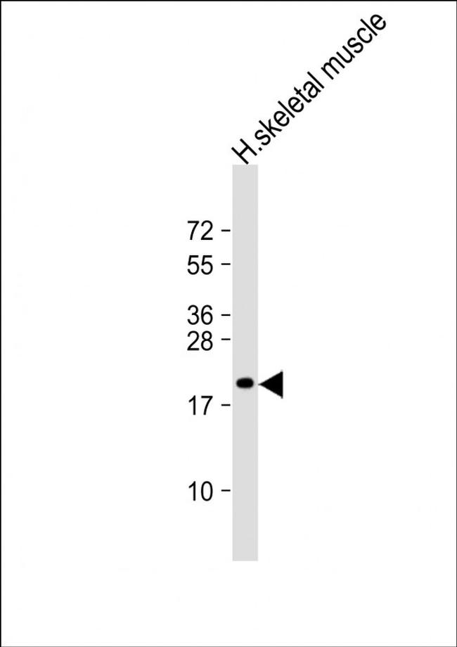 NACA2 Antibody in Western Blot (WB)