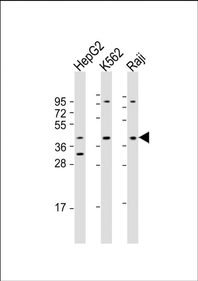 FGFR1OP Antibody in Western Blot (WB)