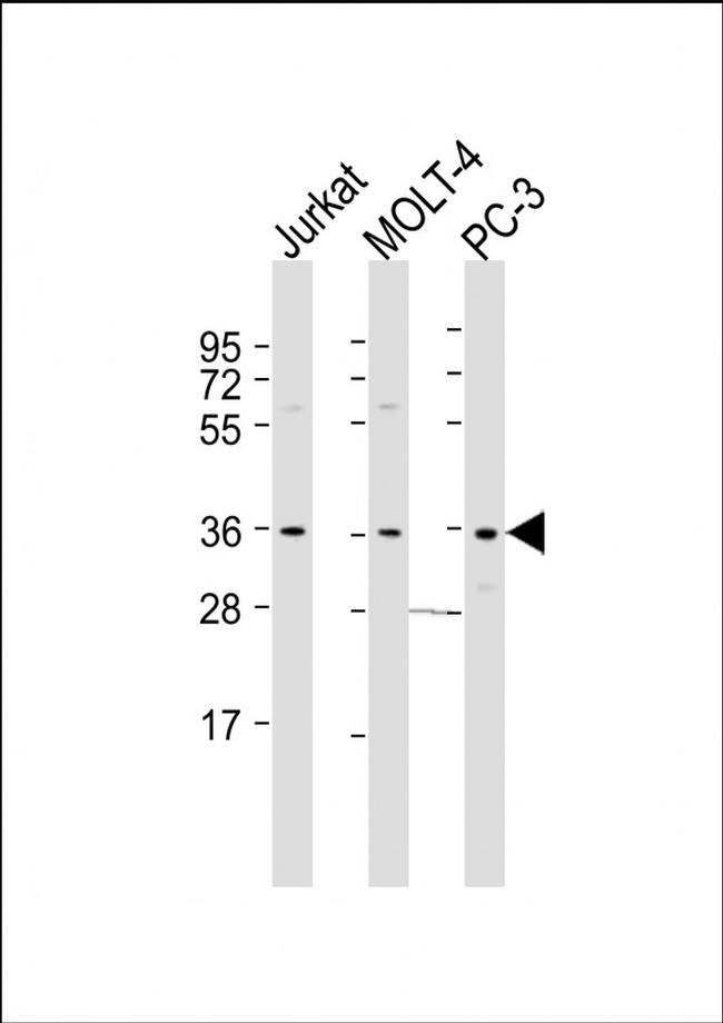 HUG1 Antibody in Western Blot (WB)
