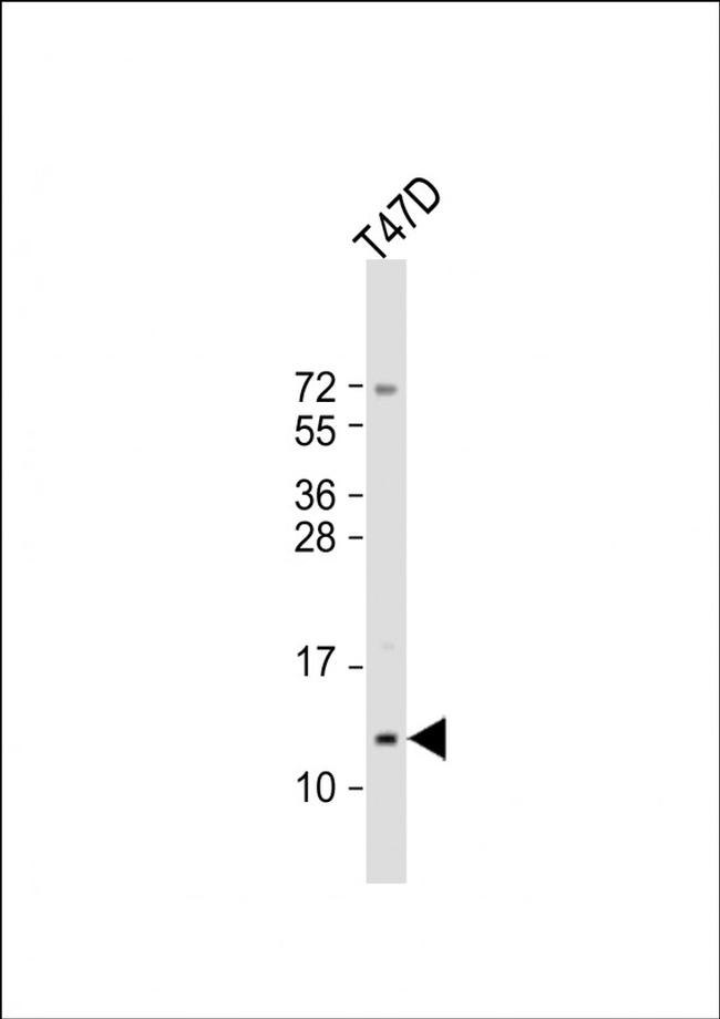 Mammaglobin A Antibody in Western Blot (WB)