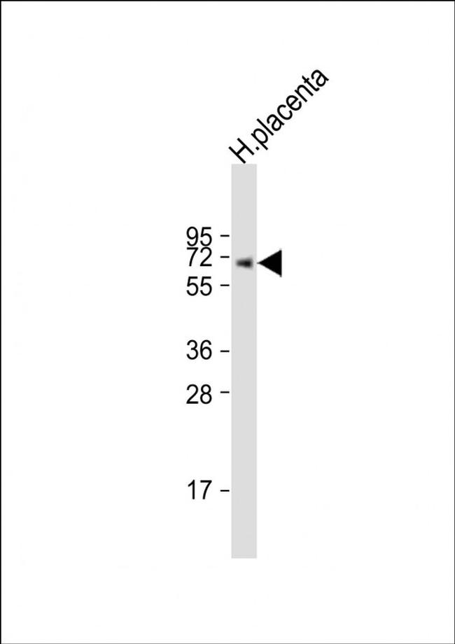 ERVK-7 Antibody in Western Blot (WB)