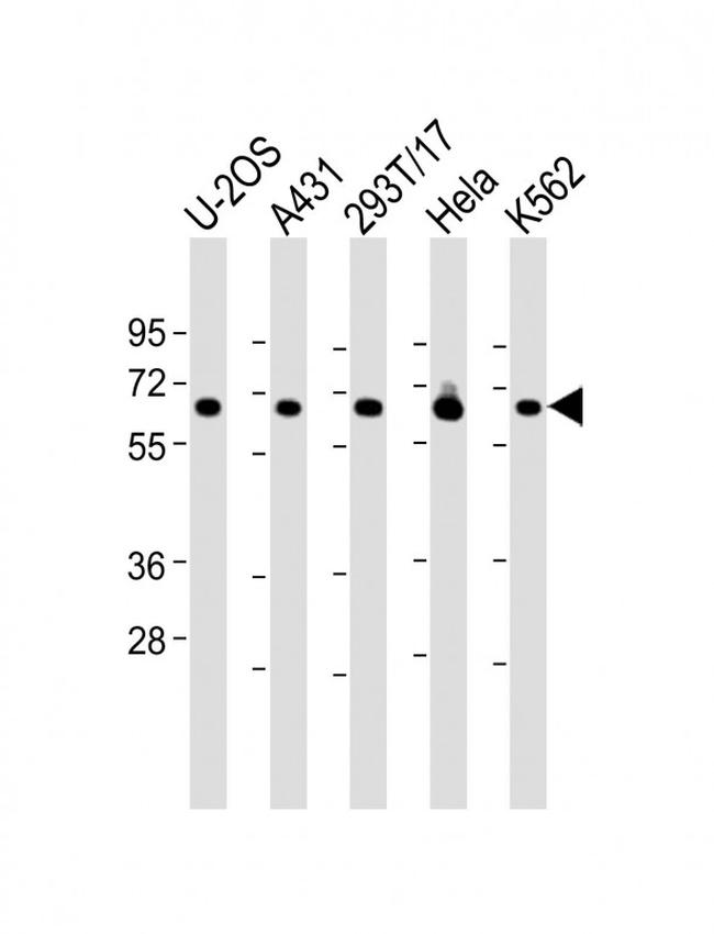 RSL1D1 Antibody in Western Blot (WB)