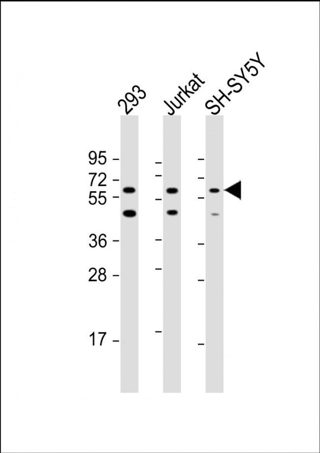 HEXDC Antibody in Western Blot (WB)