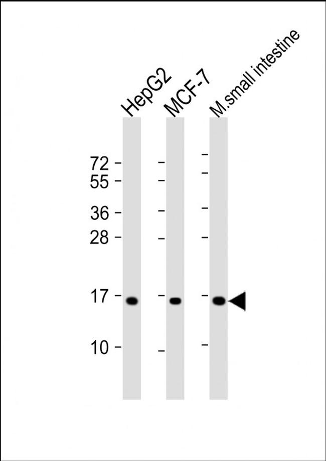 COX4I2 Antibody in Western Blot (WB)