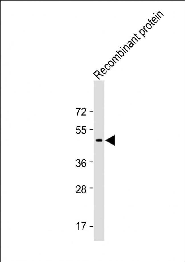 TrpE Tag Antibody in Western Blot (WB)