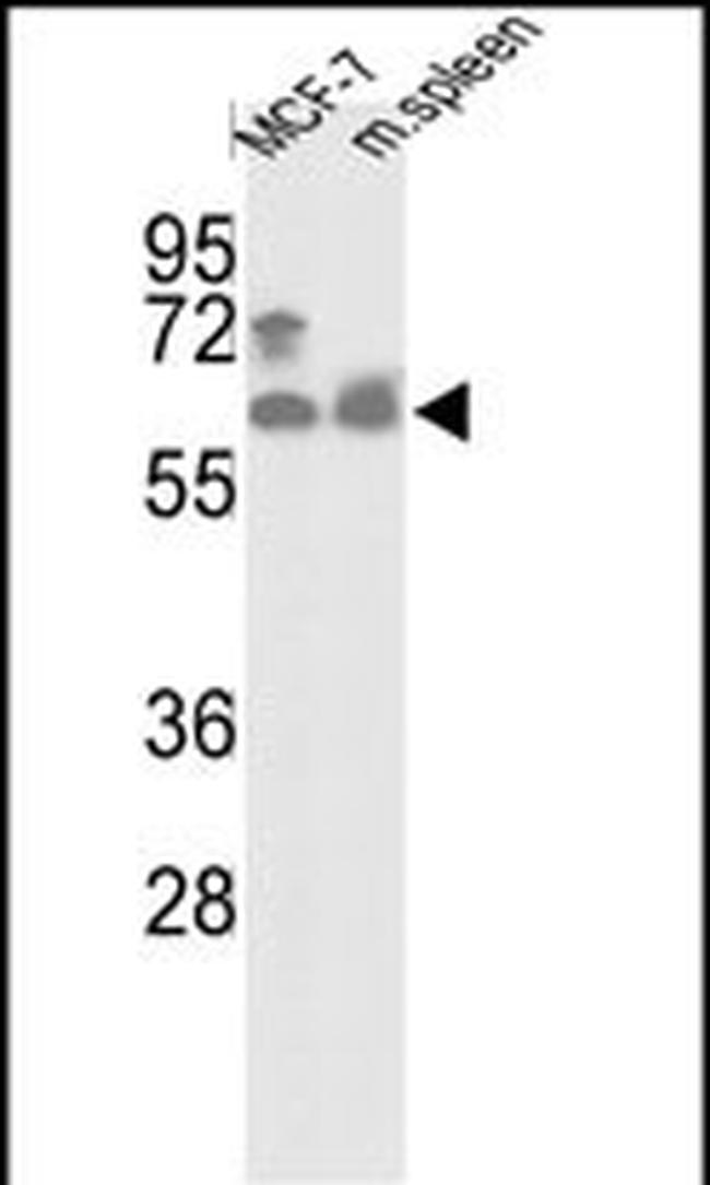 PANK1 Antibody in Western Blot (WB)