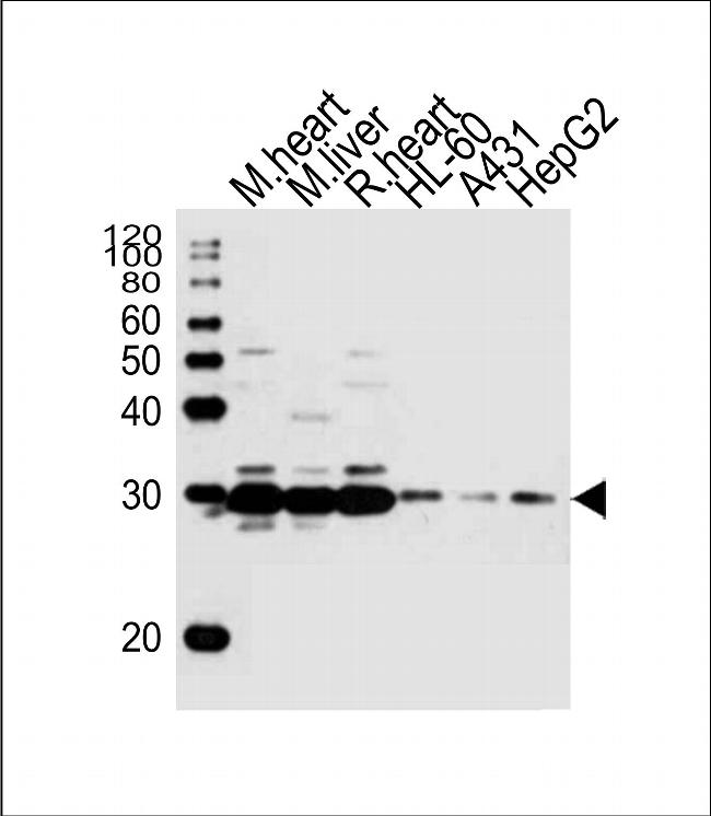 SDHB Antibody in Western Blot (WB)