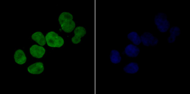 CDKN2B Antibody in Immunocytochemistry (ICC/IF)