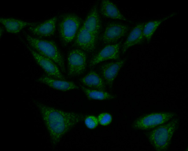 Fumarase Antibody in Immunocytochemistry (ICC/IF)
