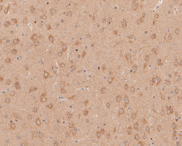 CHRNA3 Antibody in Immunohistochemistry (Paraffin) (IHC (P))
