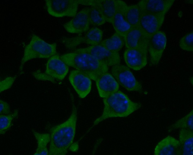 ENT1 Antibody in Immunocytochemistry (ICC/IF)